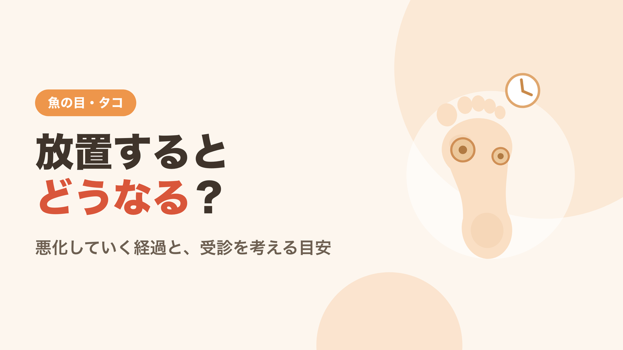 魚の目を放置するとどうなるかを解説するイメージ
